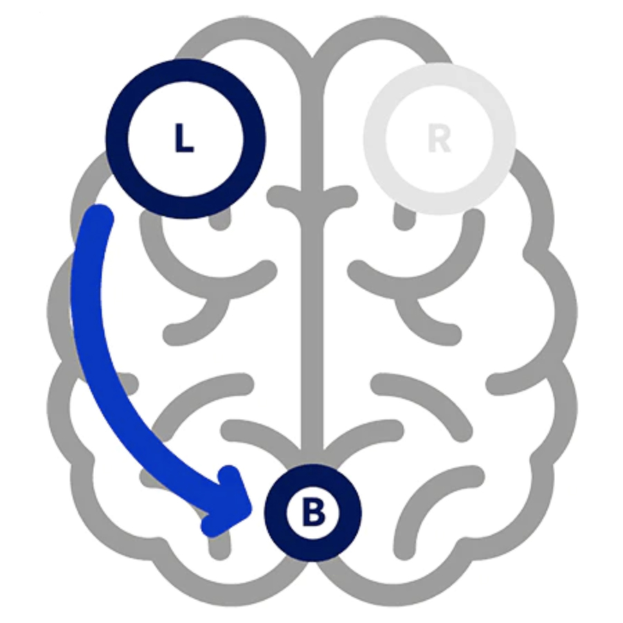 tDCS Estimulación Transcraneal por corriente directa Madrid